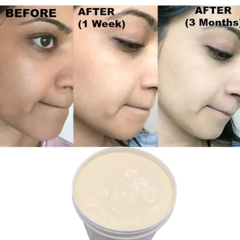 Effective Best Bleaching Whitening Cream Facial Neck Hands Feet